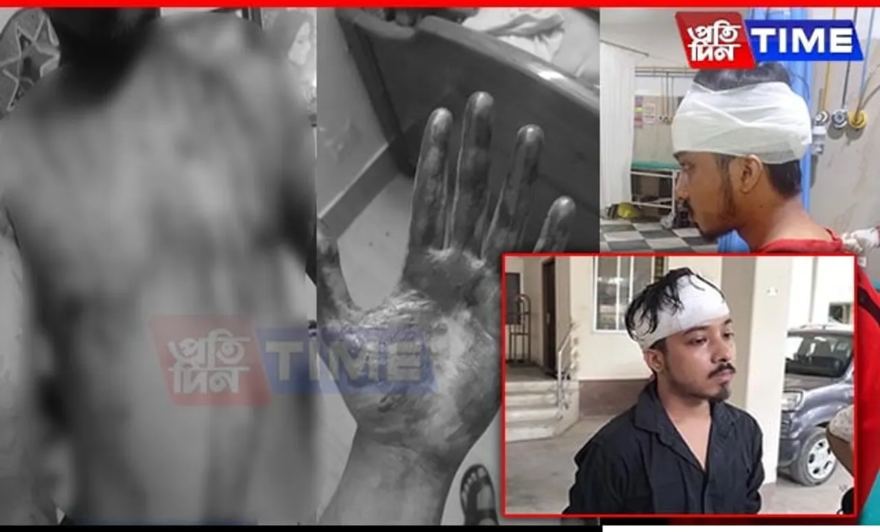 Budding Assamese Musician Attacked by Roommate and Gang in Guwahati